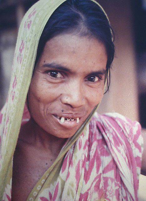 Crowned Crane - Mt. Kenya